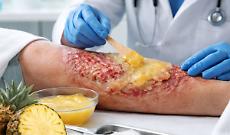 L'emergenza dopo il rogo in Svizzera: il farmaco per le ustioni &egrave; fra i medicinali carenti in Italia