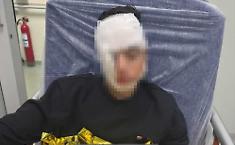 Ragazzino pestato da una baby gang in piazza Stesicoro a Catania: padre posta la foto e scatta l'appello per pi&ugrave; sicurezza