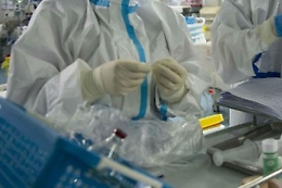 Farmaco contro Coronavirus, dall'Olanda la speranza è un anticorpo monoclonale