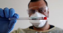 Coronavirus, al via il conto alla rovescia per il test immunologico