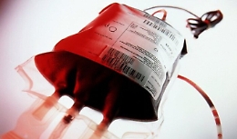 Morta a seguito di una trasfusione con sangue infetto, il Tar condanna il Ministero della Salute