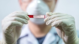 Coronavirus, i contagiati sono cinque volte in meno di quanto comunicato: come è potuto accadere?