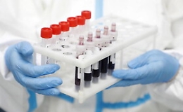 Covid, contagi in Sicilia: un solo caso in più rispetto a ieri