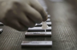 Coronavirus: test sierologici in farmacia, il ministero della Salute dice sì