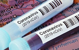 Coronavirus in Sicilia: 182 nuovi casi, ecco il bollettino del 3 ottobre