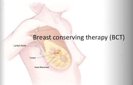 Tumore al seno, in Sicilia un centro di ricerca internazionale per sviluppare un nuovo farmaco