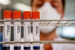 Covid, variante inglese in Sicilia: sotto esame i tamponi «anomali»