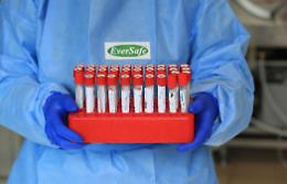 Covid, il bollettino del 25 gennaio: in Sicilia 885 nuovi casi e 34 morti