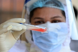 Covid, il Cts della Regione siciliana: «Non solo posti letto, potenziare i laboratori»