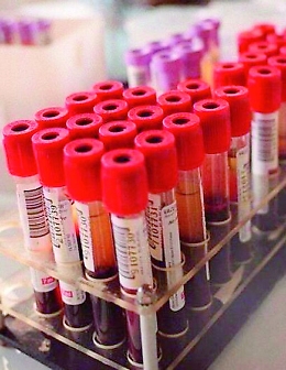 Coronavirus, dieci disabili psichici di Ribera sono risultati positivi