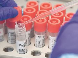 Coronavirus in Sicilia, bollettino del 17 ottobre: 475 nuovi casi e due morti