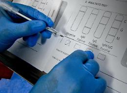 Coronavirus, a breve i test ematici per l'immunità: prima i lavoratori “strategici”