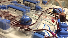 Coronavirus, nel lavaggio del sangue un nuovo “alleato”