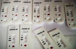 Coronavirus, in Sicilia oltre 200 laboratori privati pronti per i test sierologici