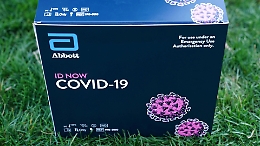 Come funziona il test sierologico approvato in Italia, ma non darà la “patente di immunità”