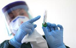 In Sicilia ancora un solo nuovo caso di coronavirus: restano 132 gli attuali positivi