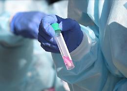 Coronavirus, in Sicilia nelle ultime 24 ore un solo caso su mille tamponi effettuati