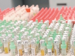 Covid test, a Catania già 300 con anticorpi