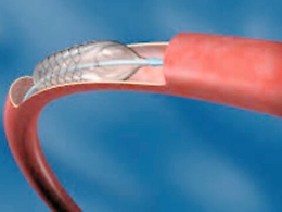 Processo stent scaduti, due imprenditori assolti