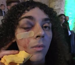 Gela, pestato in strada per il look estroso