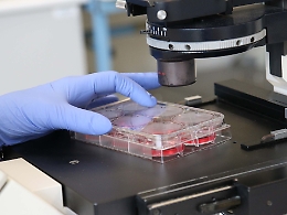 Vaccino contro tubercolosi battezzato da "Etna Biotech"