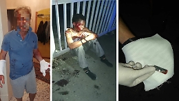 Catania, commissario aggredito, uno dei migranti ha precedenti: è polemica