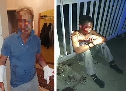 Poliziotto aggredito, revocata protezione umanitaria a ladro ghanese