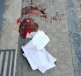 Gela, 17enne per un amore conteso accoltella coetanea all'addome