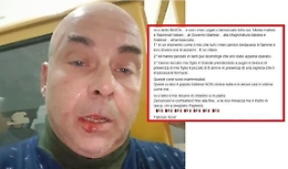 «Io picchiato dalla polizia di Malta», la denuncia di un imprenditore siciliano