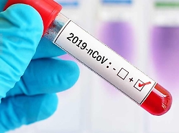 Coronavirus, c'è un nuovo caso ad Agrigento. La donna in questione è rientrata da una vacanza in Sardegna