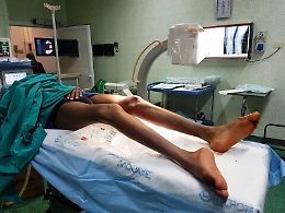 Così Mohamed dopo lo sbarco potrà ricominciare a camminare