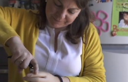 Un'altra siciliana con la mano bionica:  Clara e il tatto che sembra del tutto naturale