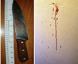 Acireale, non paga la sua parte di affitto e zio accoltella nipote