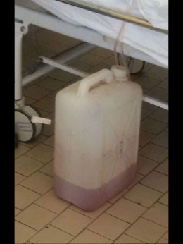 Siracusa, all'Umberto I per un lavaggio vescicale usato un bidone di plastica, inchiesta dell'Asp