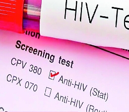 Aids e tubercolosi, in Sicilia casi quasi raddoppiati in sette anni