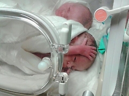 Parto trigemellare ad Agrigento, i beb&egrave; stanno tutti bene