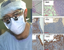 Tumori, l'arresto del processo metastatico nel sensazionale studio di un medico catanese