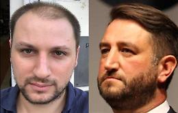 Grillini contro, Cappellani: «Follia il tunnel di Cancelleri, meglio il Ponte»