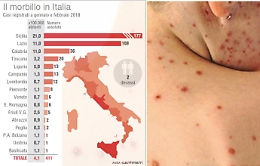Catania, sette mosse per contenere l'epidemia di morbillo