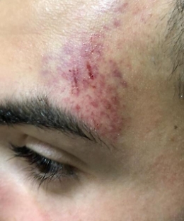 Calcio violento, la Fc Gattopardo ritira la squadra prima in classifica