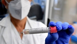 Covid, bollettino del 5 aprile: il dato del contagio in Sicilia registra 909 nuovi positivi