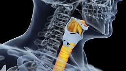 Su un siciliano primo trapianto di trachea al mondo per danni da Covid