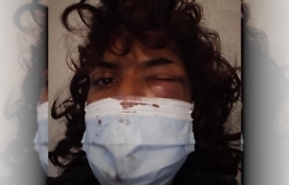 Aggressione transfobica in centro a Catania, Arcigay: subito il ddl Zan