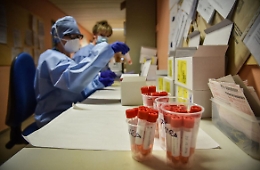 Covid, il bollettino del 31 luglio in Sicilia: +901 nuovi casi