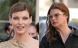 Linda Evangelista shock: «Sfigurata da un trattamento estetico»