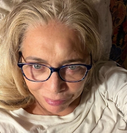 Mara Venier con un bernoccolo in testa: «Poteva andare peggio»