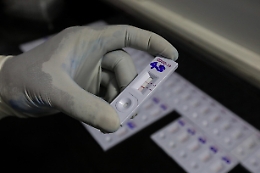 Coronavirus, il bollettino del 9 febbraio: in Sicilia 7.159 nuovi casi e altri 57 morti