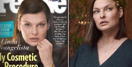 Linda Evangelista sfigurata: «Ho deciso, non mi nascondo più»