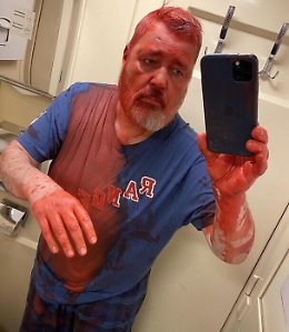 Nobel per la Pace russo Muratov assalito in treno con vernice e acetone: «Mi bruciano gli occhi»