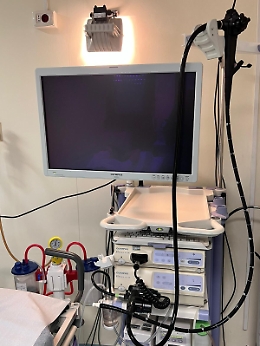 Gastroenterologia, al "Cannizzaro" un ecoendoscopio di ultima generazione per studiare i tumori